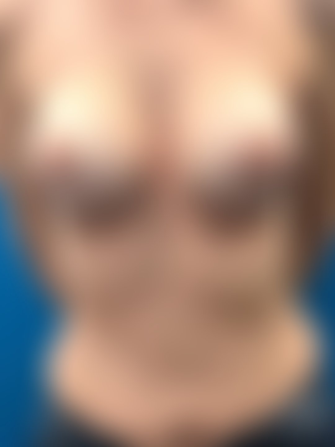 Pós