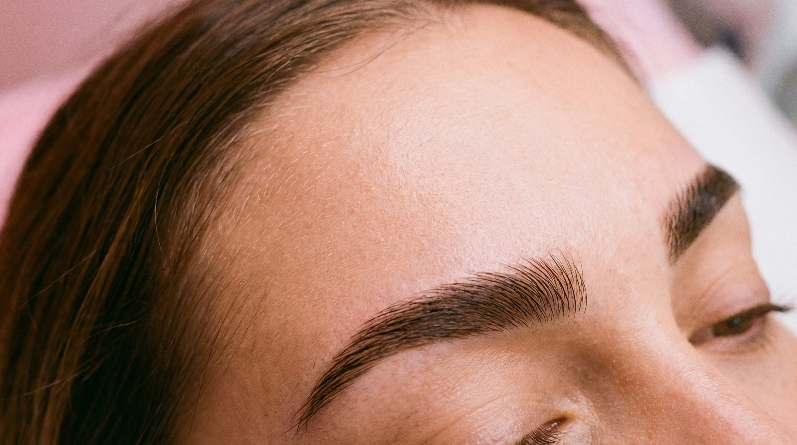 Foto ilustrativa de Capilar (alopecia, dermatite, psoríase)